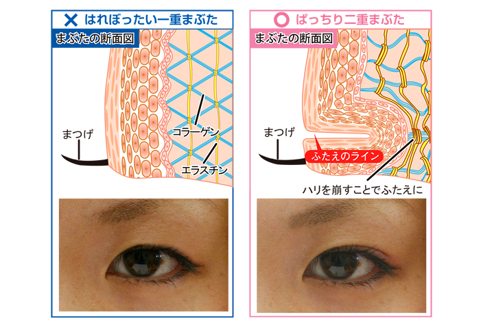 二重形成の仕組み