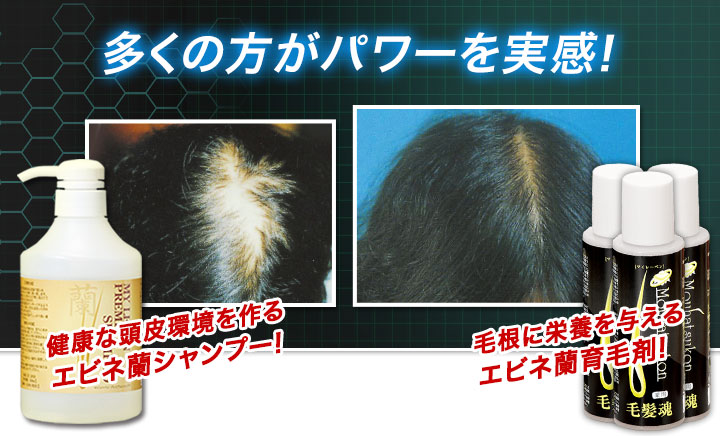 薬用育毛剤 毛髪魂マイレーベン 3本セット マイレーベンシャンプー 快適生活 ライフサポート 薬用育毛剤 毛髪魂マイレーベン 3本セット マイレーベンシャンプー 快適生活 ライフサポート