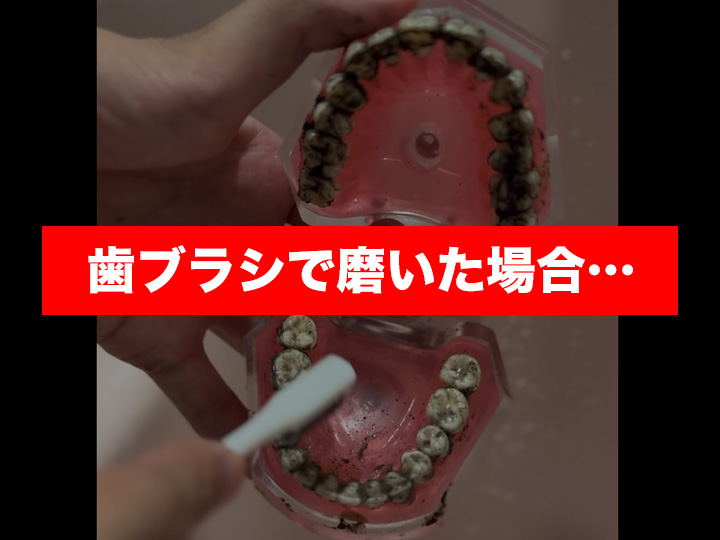 デンタルケア 口腔洗浄機 USB充電 快適生活 簡単口腔ケア